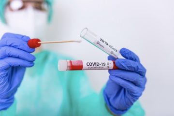 Coronavirus provincia Caltanissetta: 260 nuovi positivi