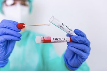 Coronavirus provincia Caltanissetta: 100 nuovi positivi e un decesso