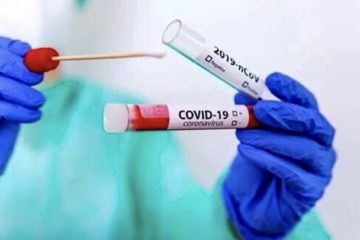 Covid, contagi in lieve aumento (+3,54%) e nuove ospedalizzazioni